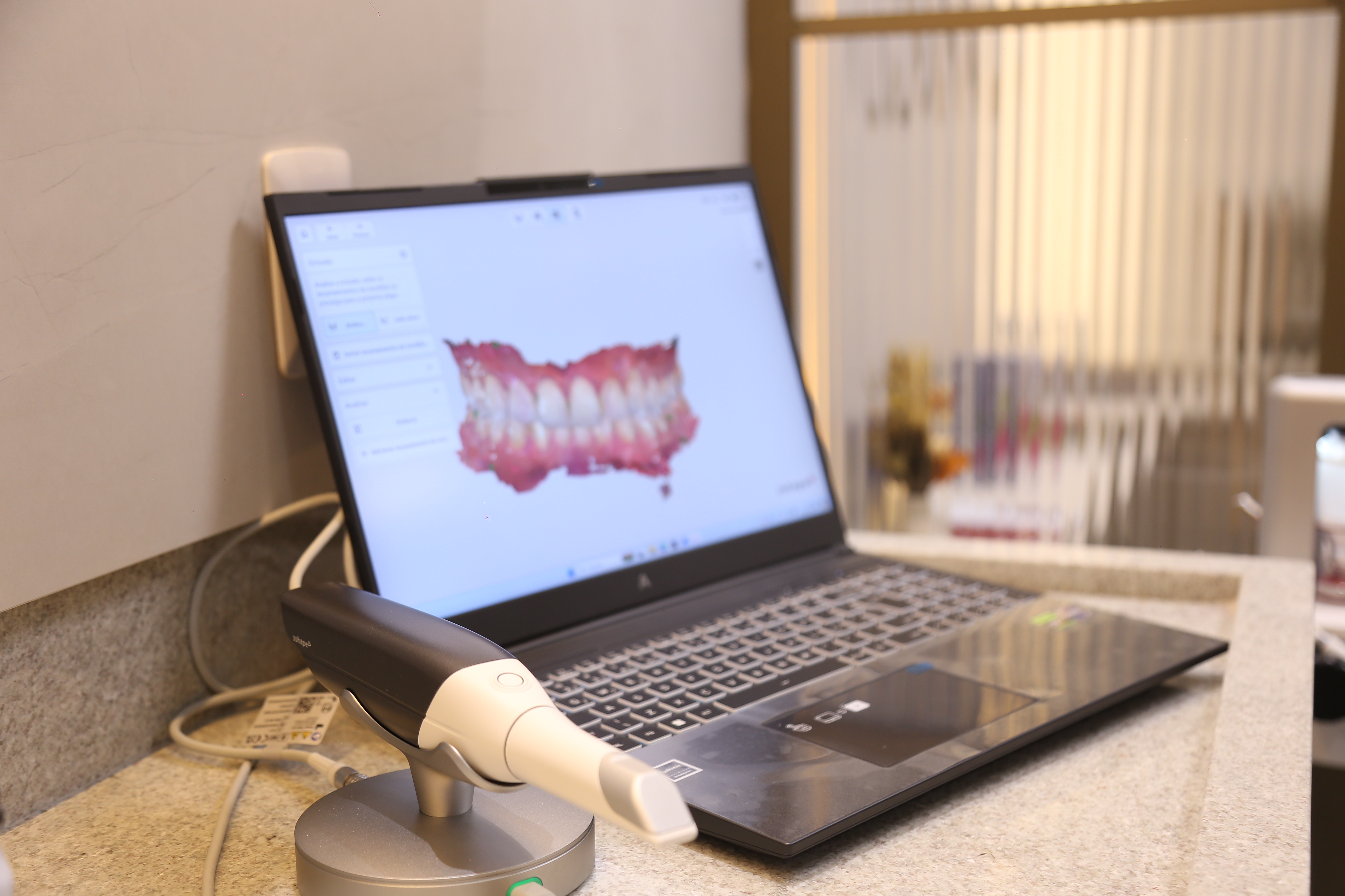 Scanner intraoral 3Shape em uso